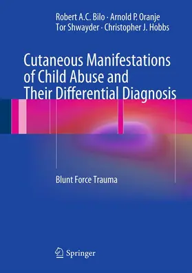 Bilo / Oranje / Shwayder |  Cutaneous Manifestations of Child Abuse and Their Differential Diagnosis | eBook | Sack Fachmedien