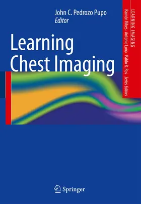 Pedrozo Pupo |  Learning Chest Imaging | Buch |  Sack Fachmedien