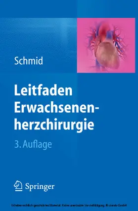 Schmid |  Leitfaden Erwachsenenherzchirurgie | eBook | Sack Fachmedien