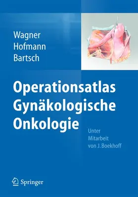 Wagner / Hofmann / Bartsch | Operationsatlas Gynäkologische Onkologie | Buch | 978-3-642-35127-3 | sack.de