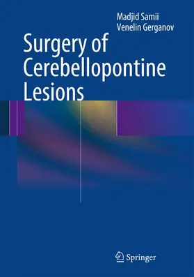 Samii / Gerganov |  Surgery of Cerebellopontine Lesions | Buch |  Sack Fachmedien