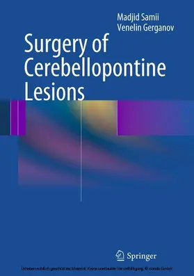 Samii / Gerganov |  Surgery of Cerebellopontine Lesions | eBook | Sack Fachmedien