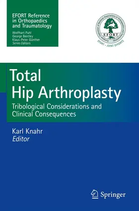 Knahr |  Total Hip Arthroplasty | eBook | Sack Fachmedien