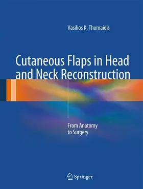 Thomaidis |  Cutaneous Flaps in Head and Neck Reconstruction | Buch |  Sack Fachmedien