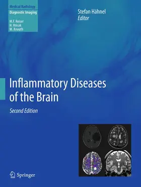 Hähnel |  Inflammatory Diseases of the Brain | Buch |  Sack Fachmedien