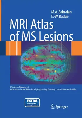 Sahraian / Radü |  MRI Atlas of MS Lesions | Buch |  Sack Fachmedien