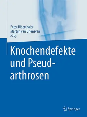 van Griensven / Biberthaler |  Knochendefekte und Pseudarthrosen | Buch |  Sack Fachmedien