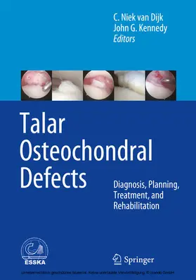 van Dijk / Kennedy |  Talar Osteochondral Defects | eBook | Sack Fachmedien