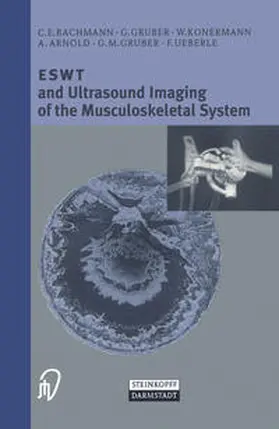Bachmann / Gruber / Konermann |  ESWT and Ultrasound Imaging of the Musculoskeletal System | eBook | Sack Fachmedien