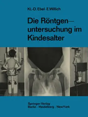 Ebel / Willich |  Die Röntgenuntersuchung im Kindesalter | eBook | Sack Fachmedien