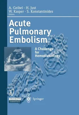 Geibel / Just / Kasper |  Acute Pulmonary Embolism | Buch |  Sack Fachmedien