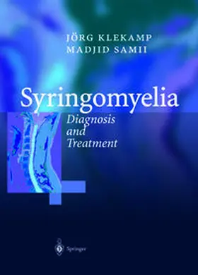 Klekamp / Samii |  Syringomyelia | eBook | Sack Fachmedien