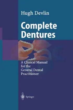 Devlin |  Complete Dentures | eBook | Sack Fachmedien