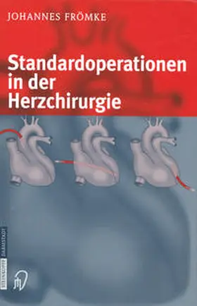 Frömke |  Standardoperationen in der Herzchirurgie | eBook | Sack Fachmedien