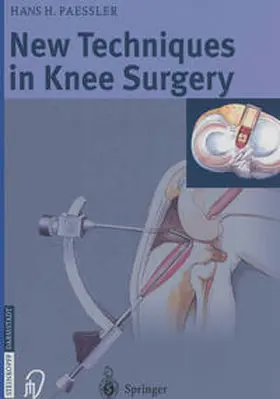 Paessler |  New Techniques in Knee Surgery | eBook | Sack Fachmedien
