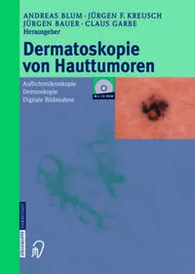 Blum / Kreusch / Bauer | Dermatoskopie von Hauttumoren | E-Book | sack.de