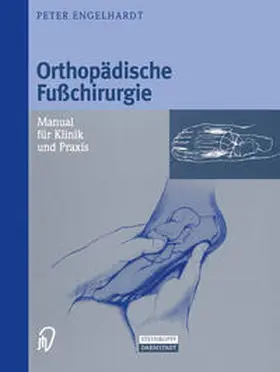 Engelhardt |  Orthopädische Fußchirurgie | eBook | Sack Fachmedien