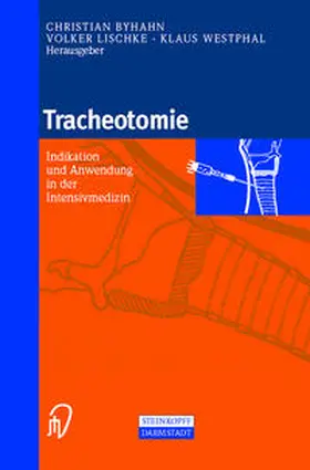 Byhahn / Lischke / Westphal | Tracheotomie | E-Book | www2.sack.de