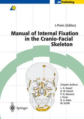 Prein |  Manual of Internal Fixation in the Cranio-Facial Skeleton | eBook | Sack Fachmedien