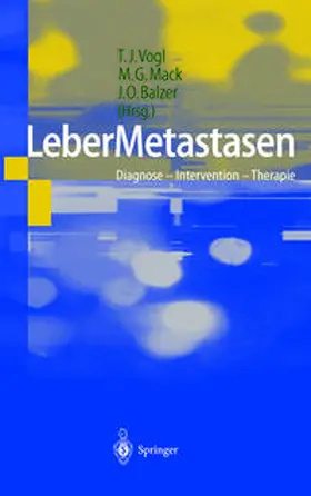 Vogl / Mack / Balzer |  LeberMetastasen | eBook | Sack Fachmedien