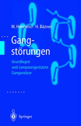 Hennerici / Bäzner |  Gangstörungen | eBook | Sack Fachmedien