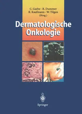 Garbe / Dummer / Kaufmann |  Dermatologische Onkologie | eBook | Sack Fachmedien