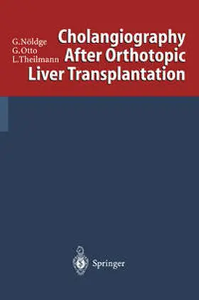 Nöldge / Otto / Theilmann |  Cholangiography After Orthotopic Liver Transplantation | eBook | Sack Fachmedien