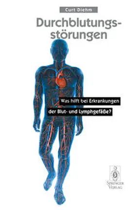 Diehm | Durchblutungsstörungen | E-Book | sack.de