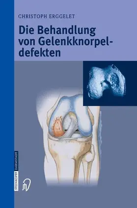 Erggelet | Die Behandlung von Gelenkknorpeldefekten | Buch | 978-3-642-62169-7 | sack.de