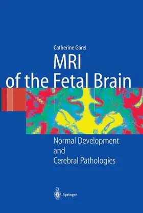 Garel |  MRI of the Fetal Brain | Buch |  Sack Fachmedien