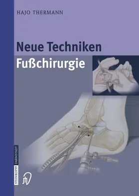 Thermann | Neue Techniken Fusschirurgie | Buch | 978-3-642-62280-9 | www2.sack.de