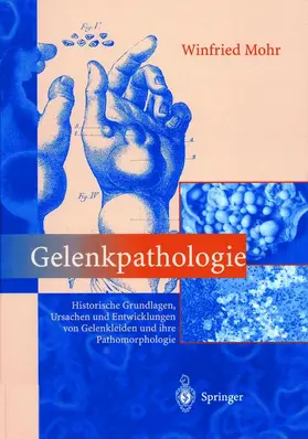 Mohr |  Gelenkpathologie | Buch |  Sack Fachmedien