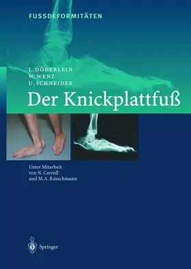 Wenz / Döderlein / Schneider |  FussdeformitÄten | Buch |  Sack Fachmedien