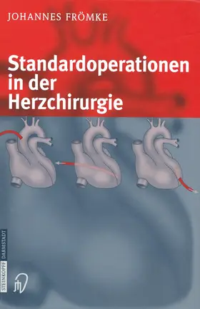 Frömke | Standardoperationen in der Herzchirurgie | Buch | 978-3-642-63247-1 | sack.de