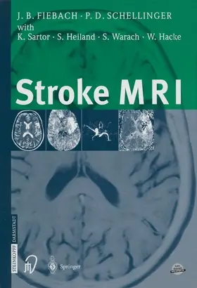 Fiebach / Schellinger / Sartor |  Stroke MRI | Buch |  Sack Fachmedien