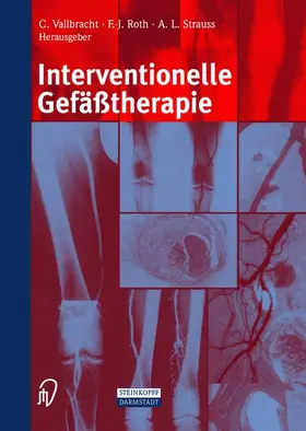 Vallbracht / Roth / Strauss |  Interventionelle Gefäßtherapie | Buch |  Sack Fachmedien