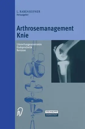 Rabenseifner |  Arthrosemanagement Knie | Buch |  Sack Fachmedien