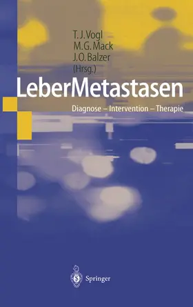 Vogl / Mack / Balzer | LeberMetastasen | Buch | 978-3-642-63958-6 | www2.sack.de