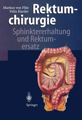 Flüe / Harder |  Rektumchirurgie | Buch |  Sack Fachmedien