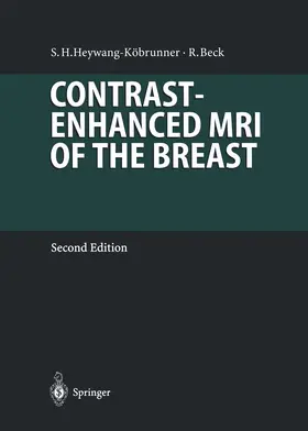 Heywang-Köbrunner / Beck |  Contrast-Enhanced MRI of the Breast | Buch |  Sack Fachmedien