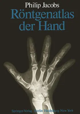 Jacobs |  Röntgenatlas der Hand | eBook | Sack Fachmedien