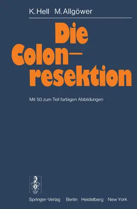 Allgöwer / Hell |  Die Colonresektion | Buch |  Sack Fachmedien