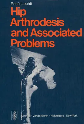 Liechti / Casey |  Hip Arthrodesis and Associated Problems | Buch |  Sack Fachmedien
