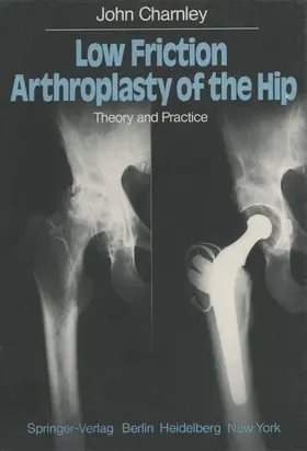 Charnley |  Low Friction Arthroplasty of the Hip | Buch |  Sack Fachmedien