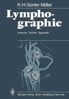Müller |  Lymphographie | eBook | Sack Fachmedien