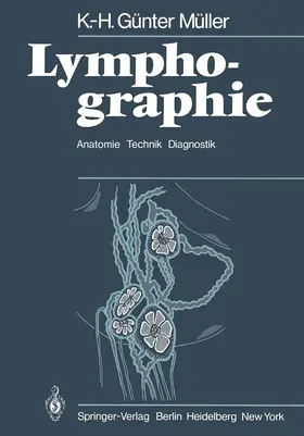 Müller |  Lymphographie | Buch |  Sack Fachmedien