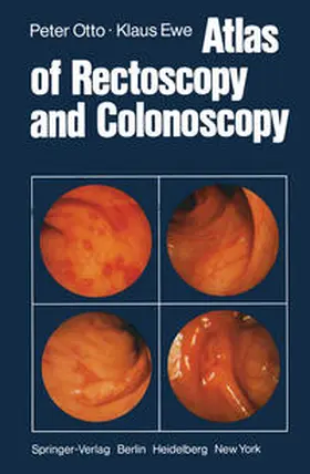 Otto / Ewe |  Atlas of Rectoscopy and Coloscopy | eBook | Sack Fachmedien