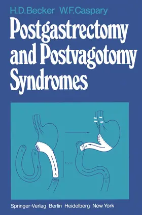 Becker / Caspary |  Postgastrectomy and Postvagotomy Syndromes | Buch |  Sack Fachmedien