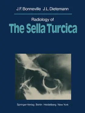 Bonneville / Dietemann |  Radiology of The Sella Turcica | eBook | Sack Fachmedien