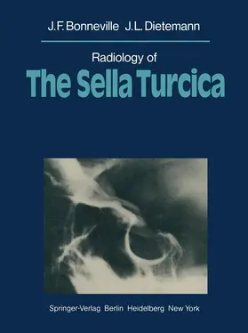 Bonneville / Dietemann |  Radiology of The Sella Turcica | Buch |  Sack Fachmedien